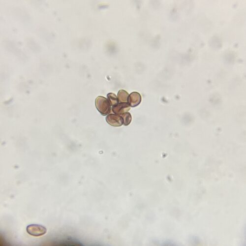 Z-Strain Spores underneath the microscope