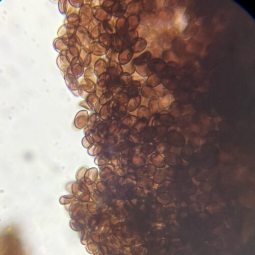 Z-Strain Spores underneath the microscope